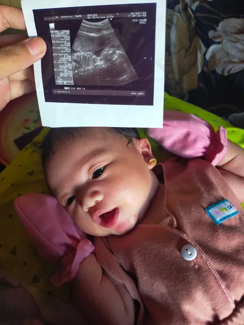 Foto sampul undangan Tasyakuran Aqiqah Annisa Sanari Azkiya